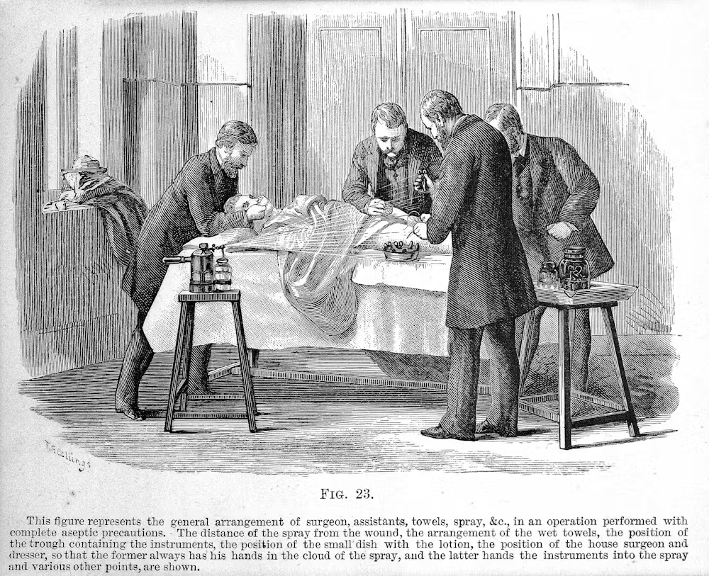 Lister antiseptic spray. Antique illustration portraying surgery.