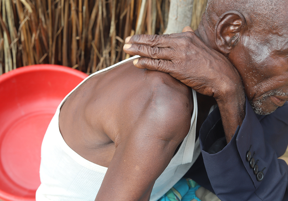 Seventy-nine-year-old Karisa Ndenge displays his scars from an attack a few years ago, during which he said members of his family and community attacked him with machetes. He managed to escape and sought refuge at one of the centers in the Kilifi region. (GSR photo/Doreen Ajiambo)
